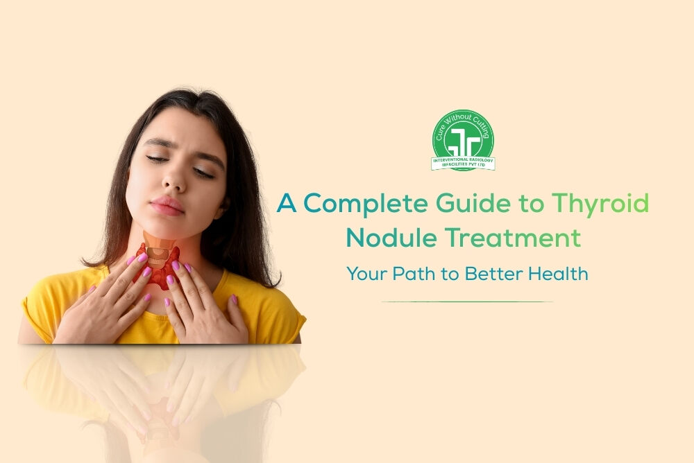 A Complete Guide to Thyroid Nodule Treatment Your Path to Better Health