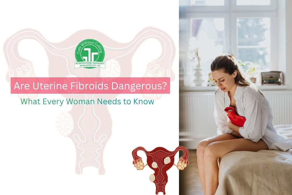 Are Uterine Fibroids Dangerous What Every Woman Needs to Know