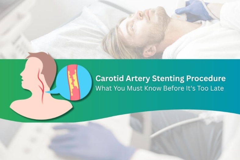 Carotid Artery Stenting Procedure What You Must Know Before It's Too Late