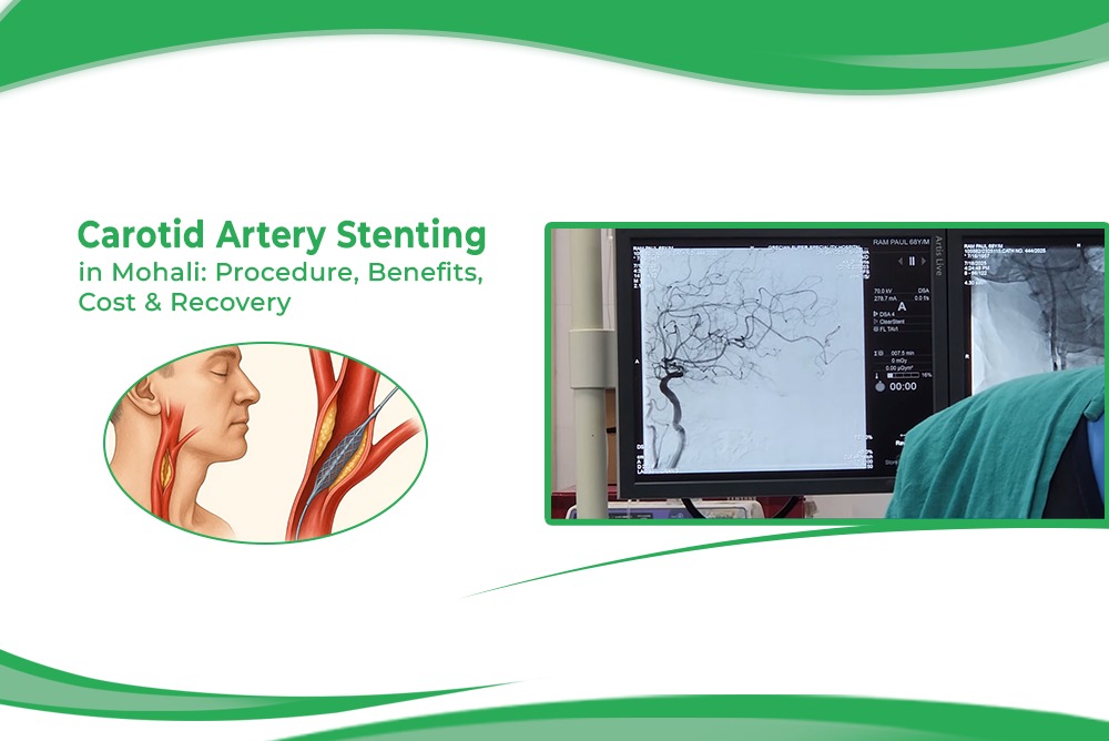 Carotid Artery Stenting in Mohali Procedure Benefits Cost Recovery
