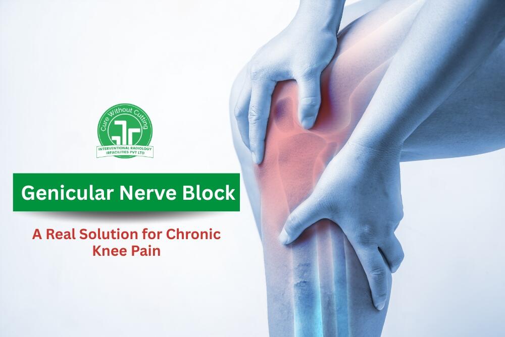 Genicular Nerve Block  A Real Solution for Chronic Knee Pain