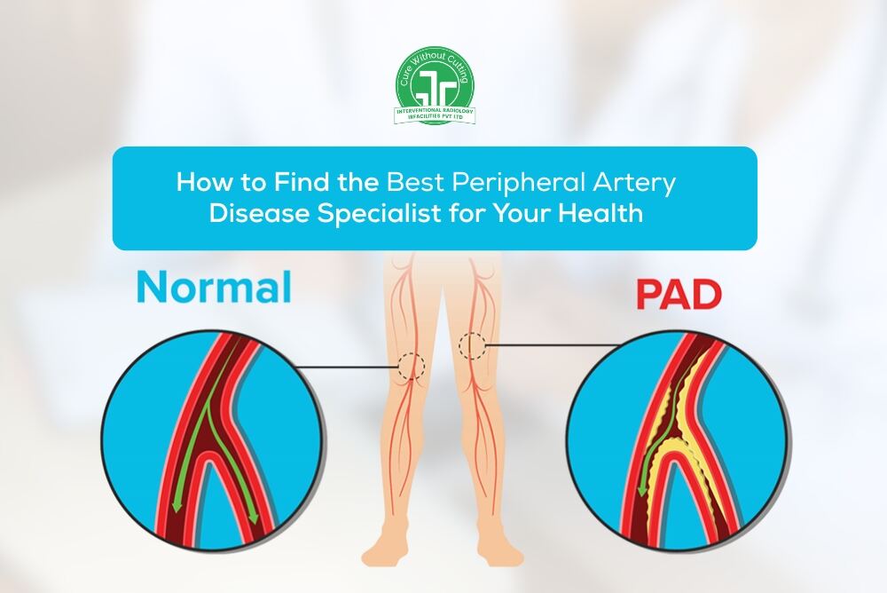 How to Find the Best Peripheral Artery Disease Specialist for Your Health