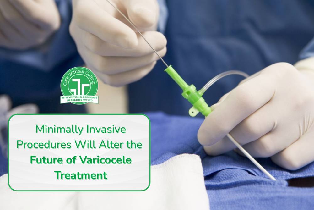 Minimally Invasive Procedures Will Alter the Future of Varicocele Treatment