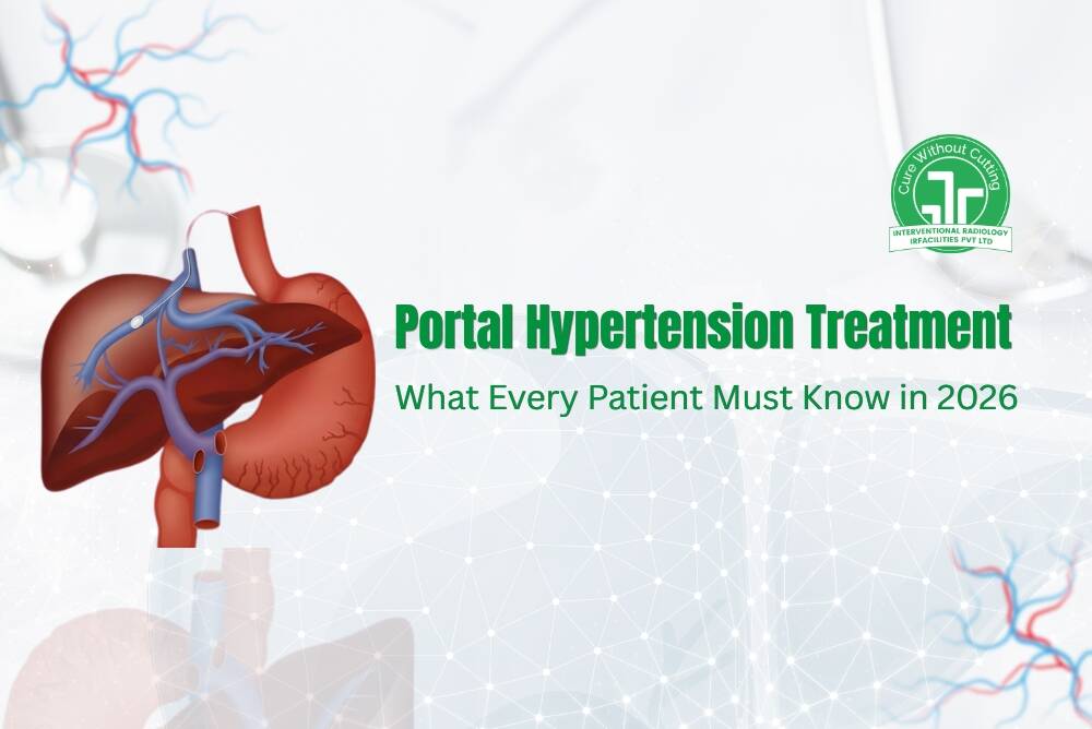 Portal Hypertension Treatment: What Every Patient Must Know in 2026
