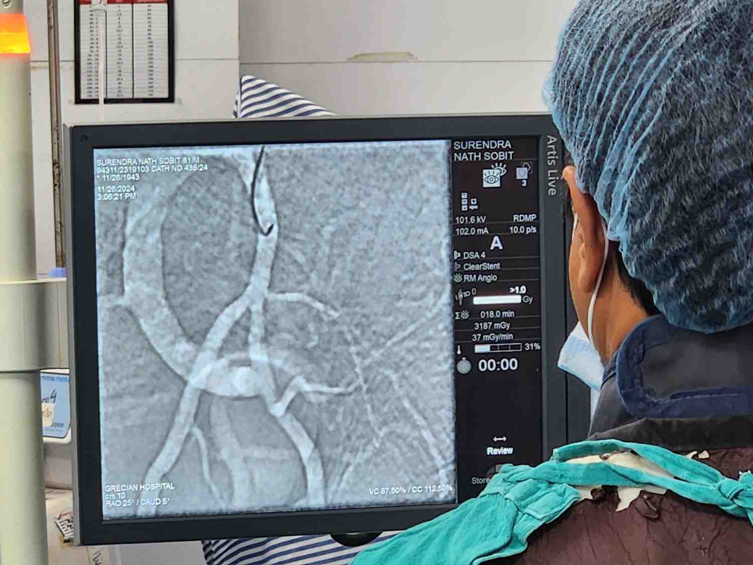 Prosthetic Artery Embolization at IRFacilities
