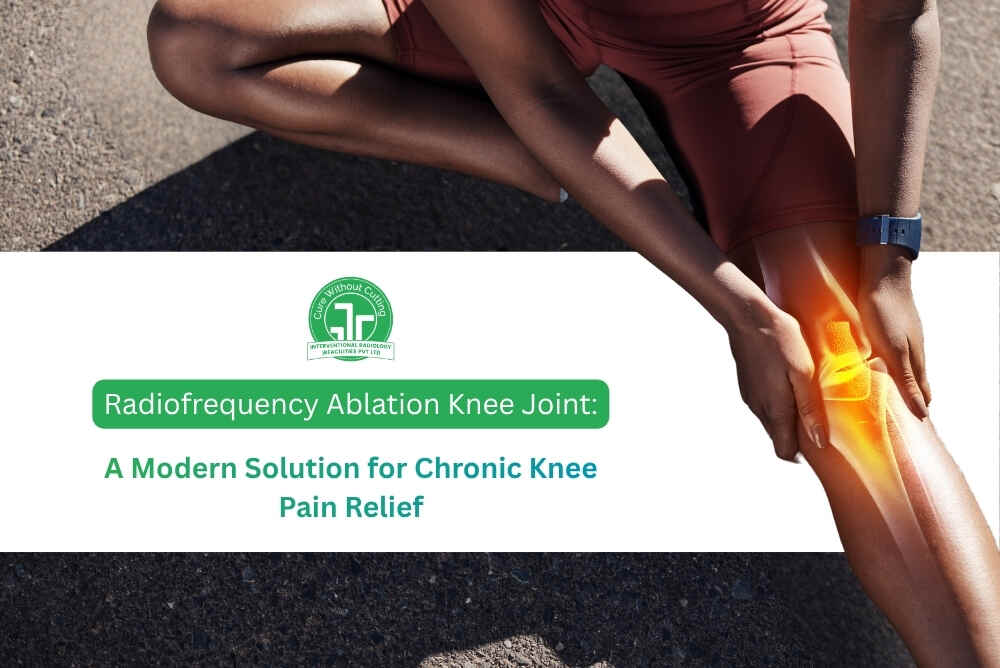 Radiofrequency Ablation Knee Joint A Modern Solution for Chronic Knee Pain Relief