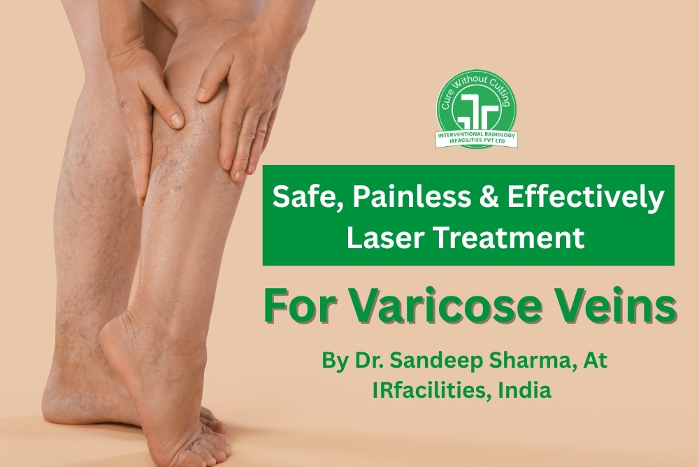 Safe,-Painless-Effectively-Laser-Treatment-For-Varicose-Veins-By-Dr-Sandeep-Sharma-At-IRfacilities-India.jpg
