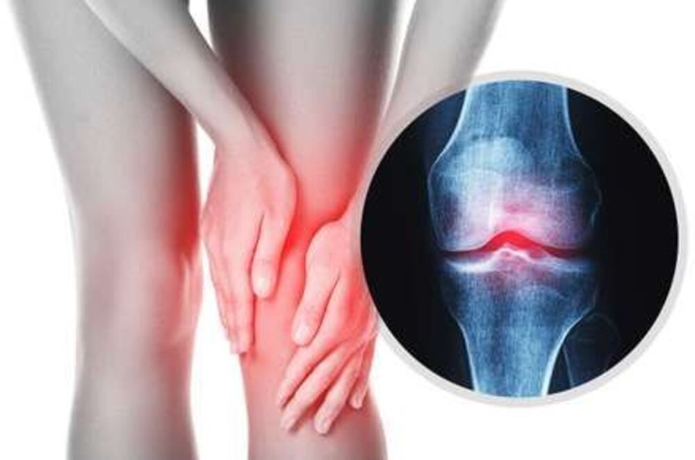 Symptoms of Knee Osteoarthritis