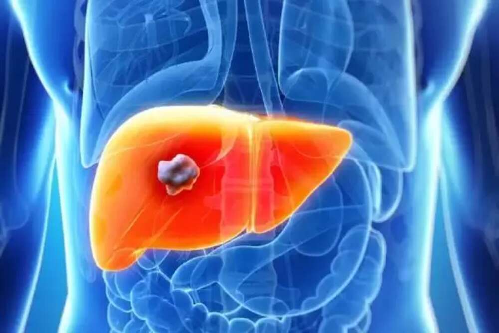 Symptoms of Liver Abscess