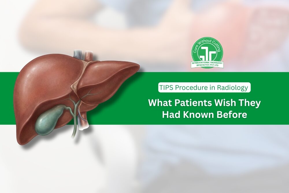 TIPS Procedure in Radiology What Patients Wish They Had Known Before