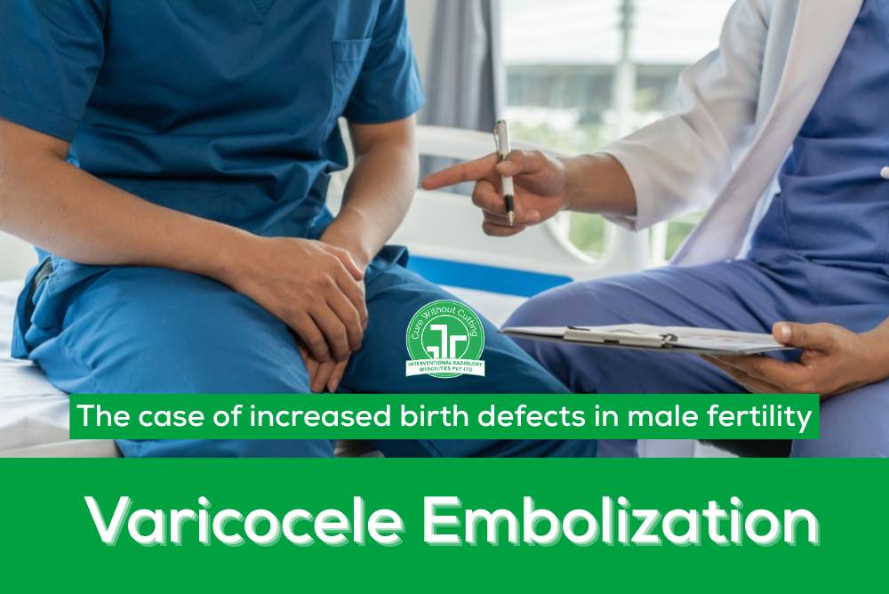 The case of increased birth defects in male fertility varicocele embolization