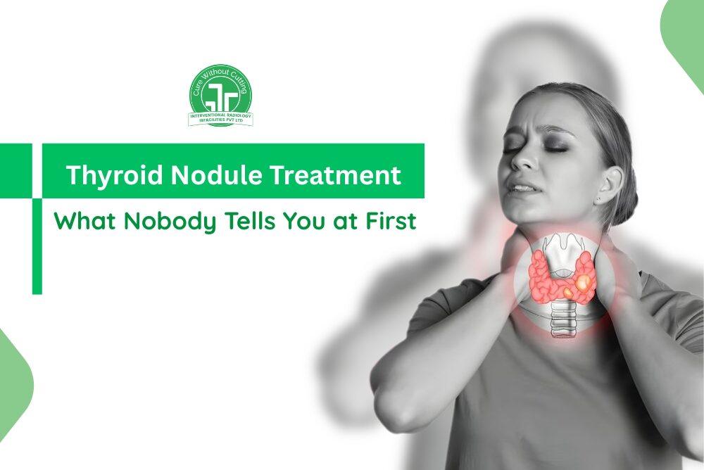 Thyroid Nodule Treatment: What Nobody Tells You at First