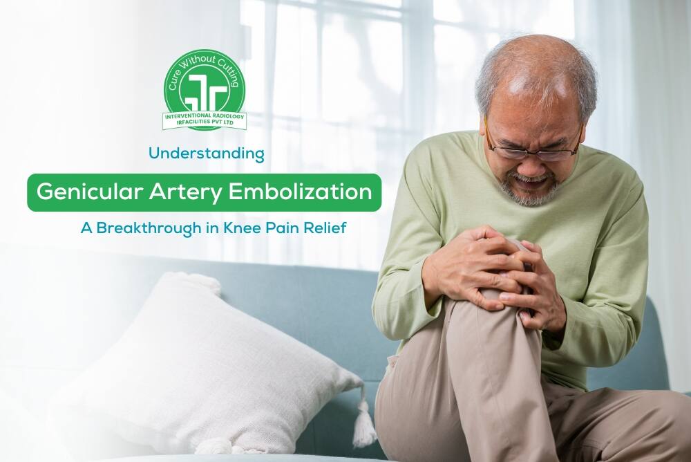 Understanding Genicular Artery Embolization: A Breakthrough in Knee Pain Relief