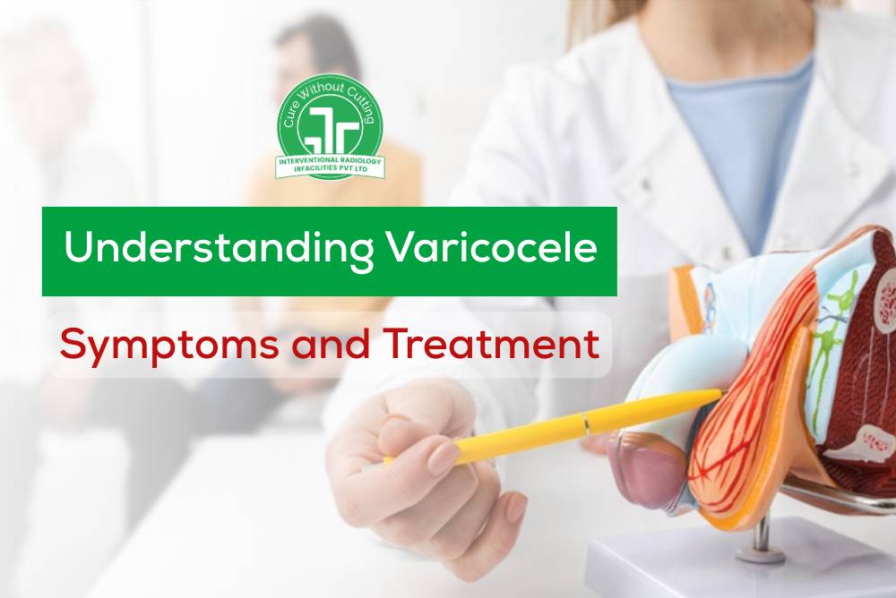 Understanding Varicocele Symptoms and Treatment