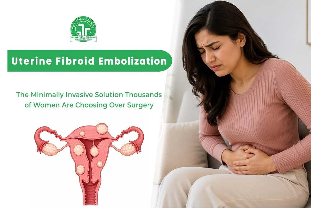 Uterine Fibroid Embolization The Minimally Invasive Solution Thousands of Women Are Choosing Over Surgery