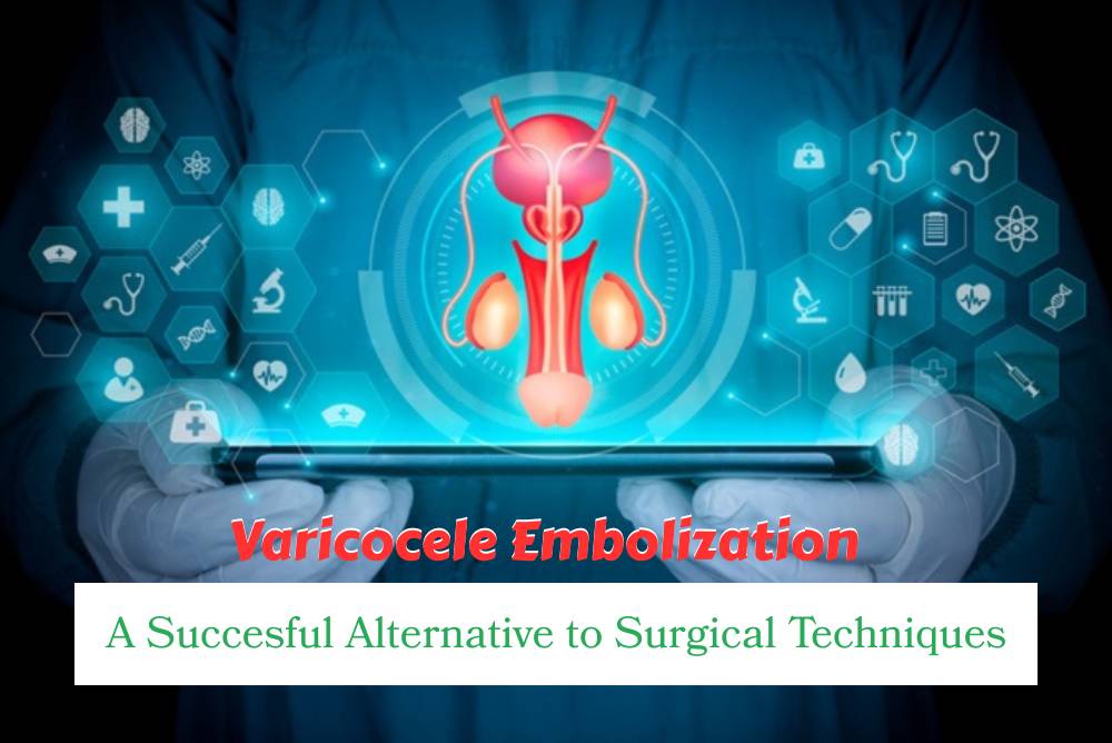 Varicocele Embolization A succesful Alternative_to Surgical Techniques