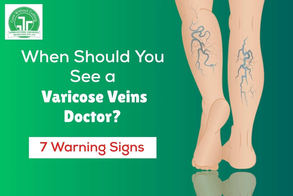 When should you see a varicose veins doctor – 7 warning signs