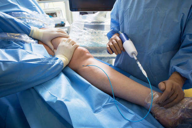 carotid stenting