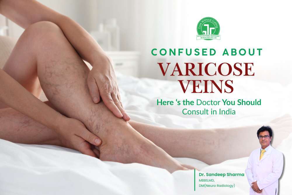 patient showing varicose veins for consultation