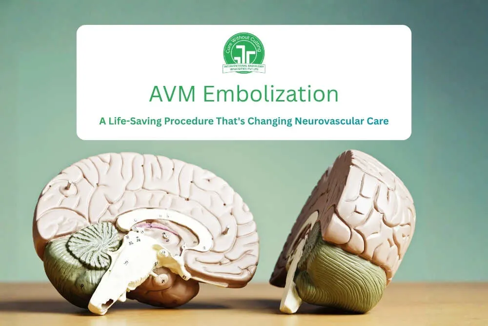 AVM Embolization: A Life-Saving Procedure That's Changing Neurovascular Care