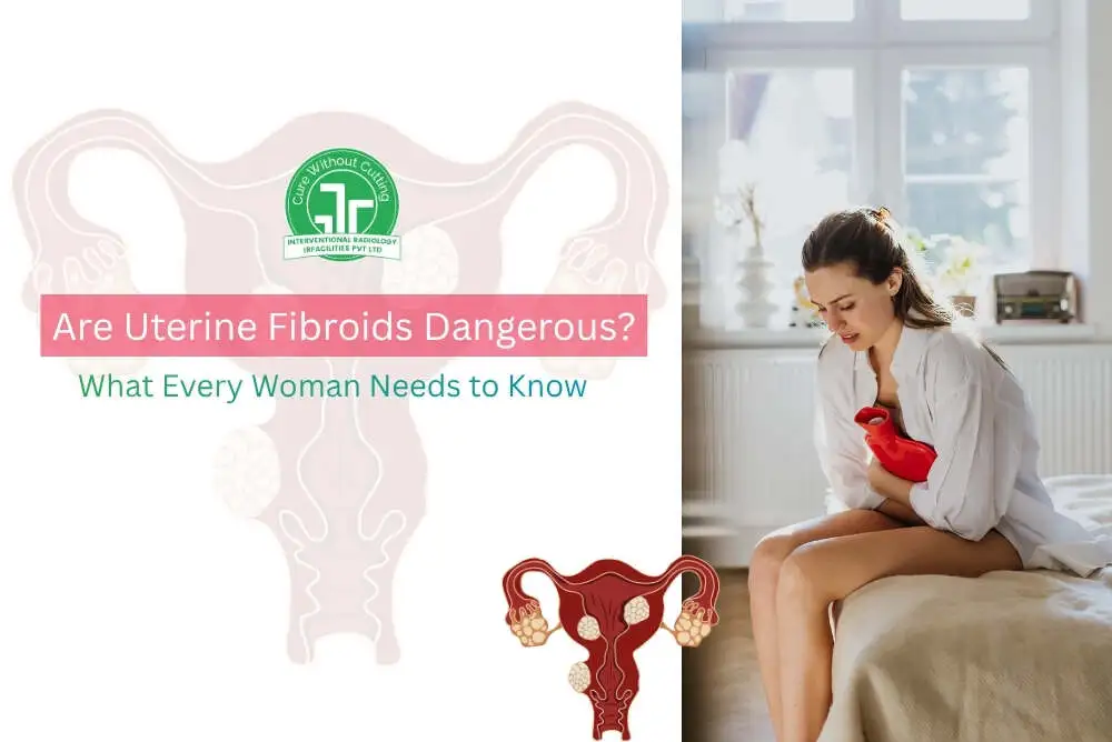 Are Uterine Fibroids Dangerous What Every Woman Needs to Know