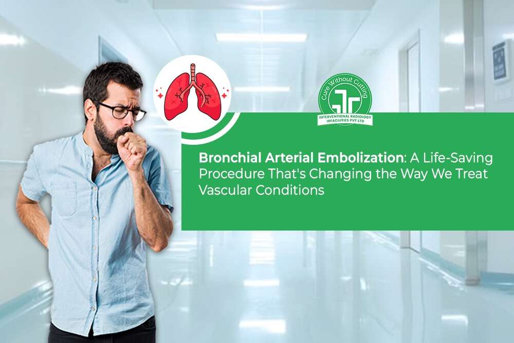 Arterial Embolization A Life Saving Procedure Thats Changing the Way We Treat Vascular Conditions
