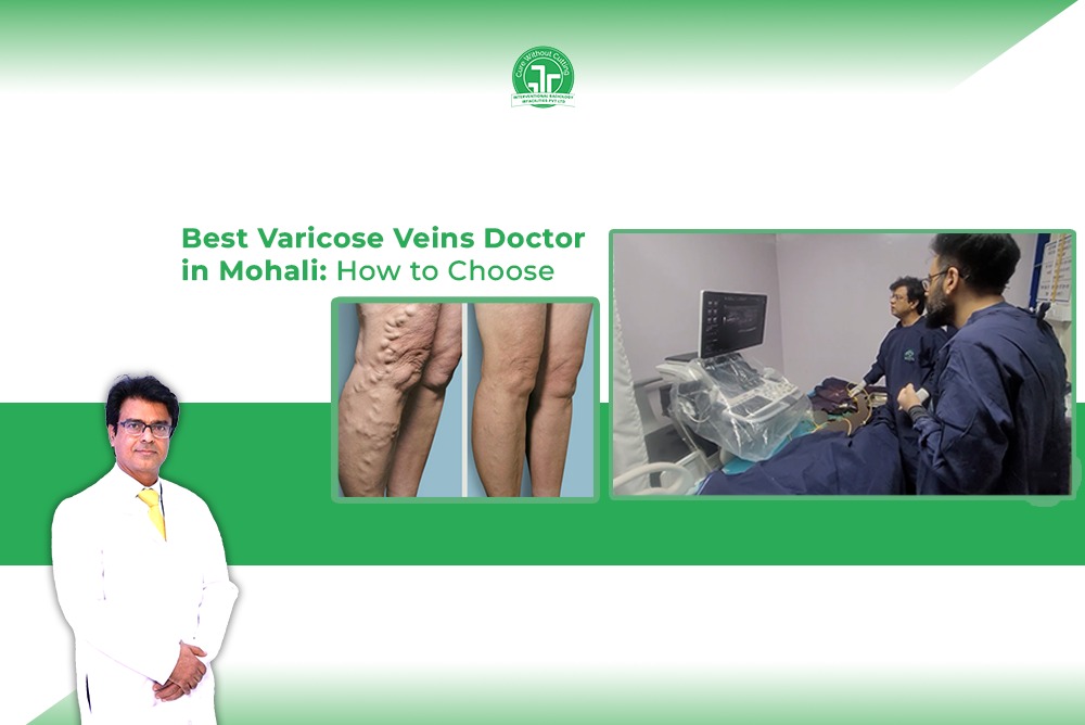 Best Varicose Veins Doctor in Mohali How to Choose