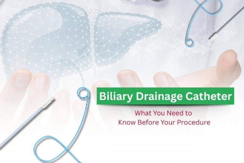Biliary Drainage Catheter: What You Need to Know Before Your Procedure