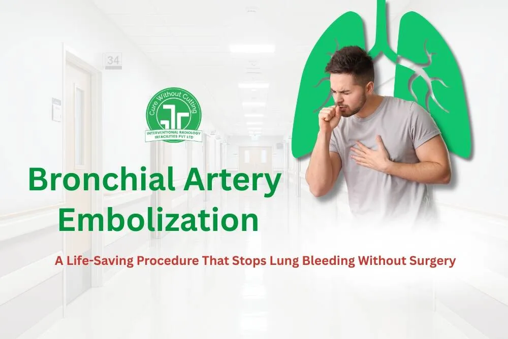 Bronchial Artery Embolization  A Life Saving Procedure That Stops Lung Bleeding Without Surgery