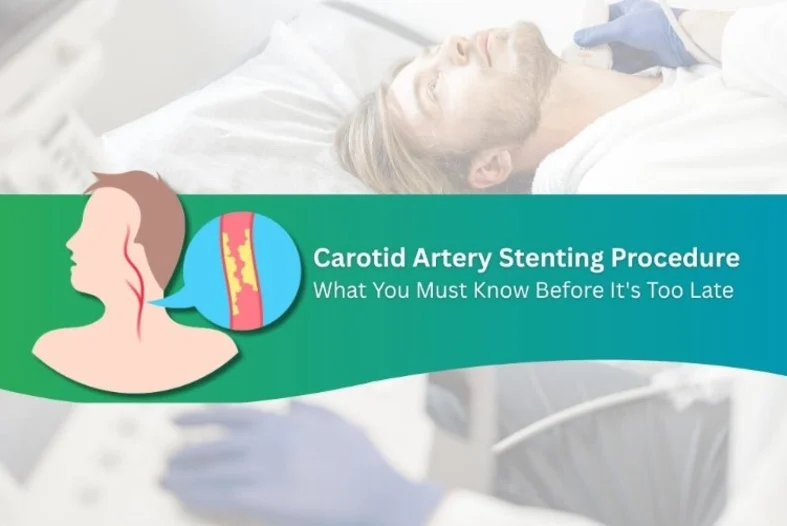 Carotid Artery Stenting Procedure What You Must Know Before It's Too Late