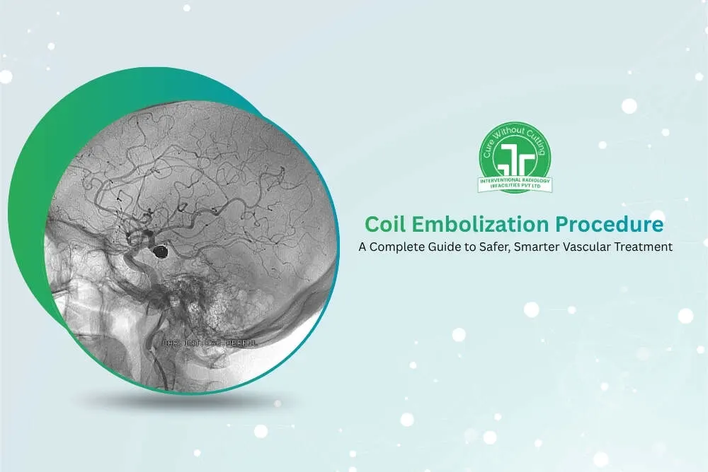 Coil Embolization Procedure A Complete Guide to Safer Smarter Vascular Treatment