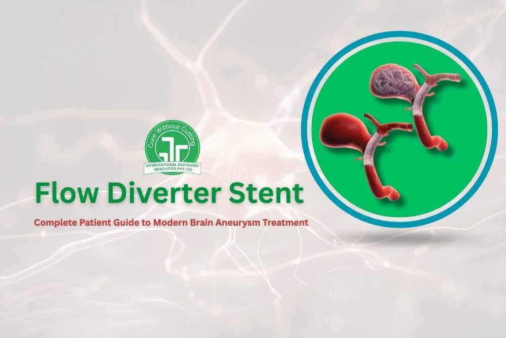 Flow Diverter Stent Complete Patient Guide to Modern Brain Aneurysm Treatment
