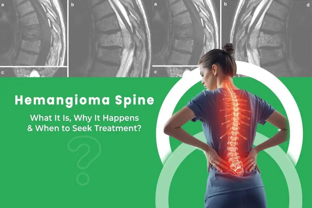 Hemangioma Spine What It Is Why It Happens When to Seek Treatment