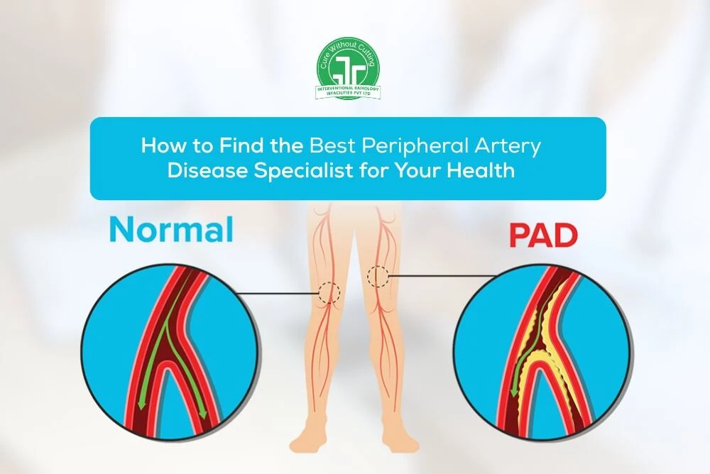 How-to-Find-the-Best-Peripheral-Artery-Disease-Specialist-for-Your-Health