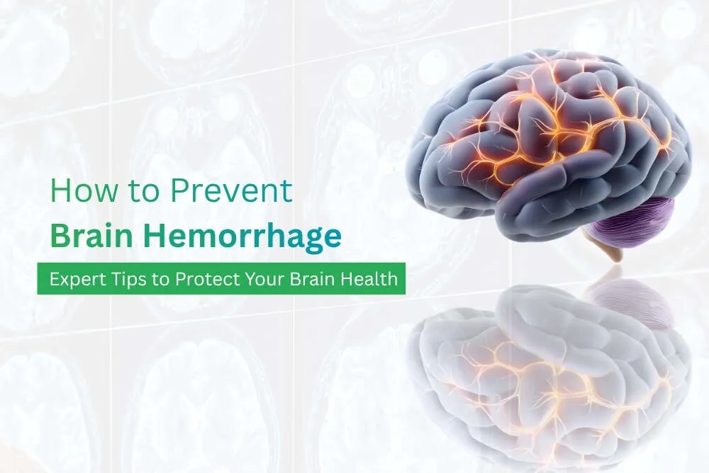 How to Prevent Brain Hemorrhage Expert Tips to Protect Your Brain Health