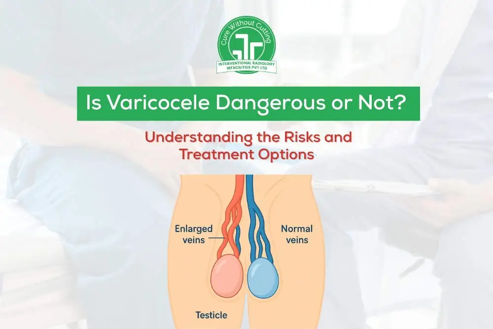 Varicocele