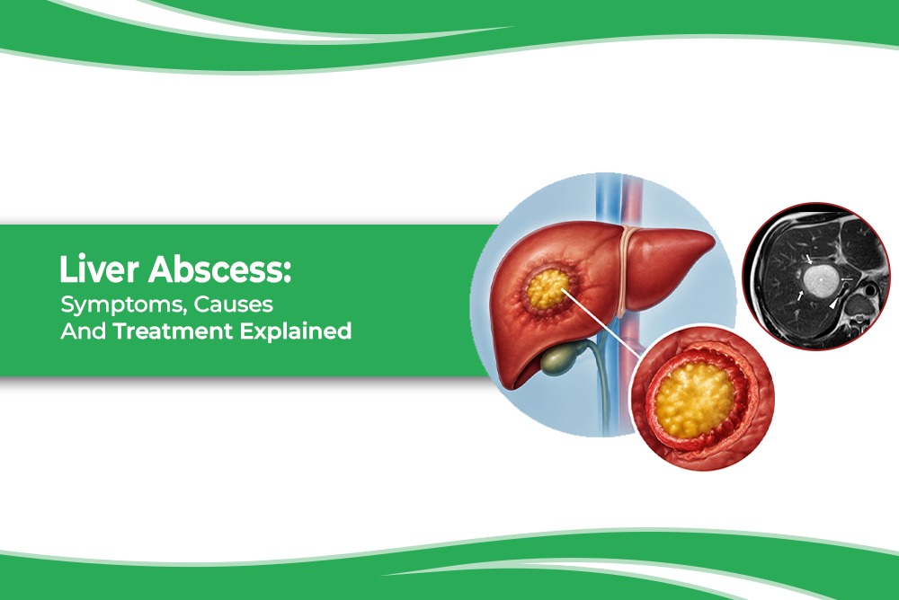 Liver Abscess Symptoms Causes And Treatment Explained