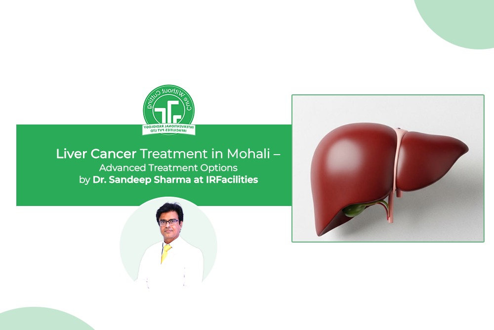 Liver Cancer Treatment in Mohali Advanced Treatment Options by Dr Sandeep Sharma at IRFacilities