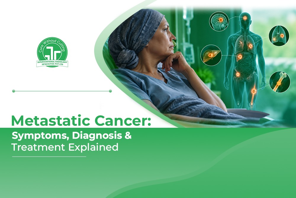 Metastatic Cancer Symptoms Diagnosis Treatment Explained
