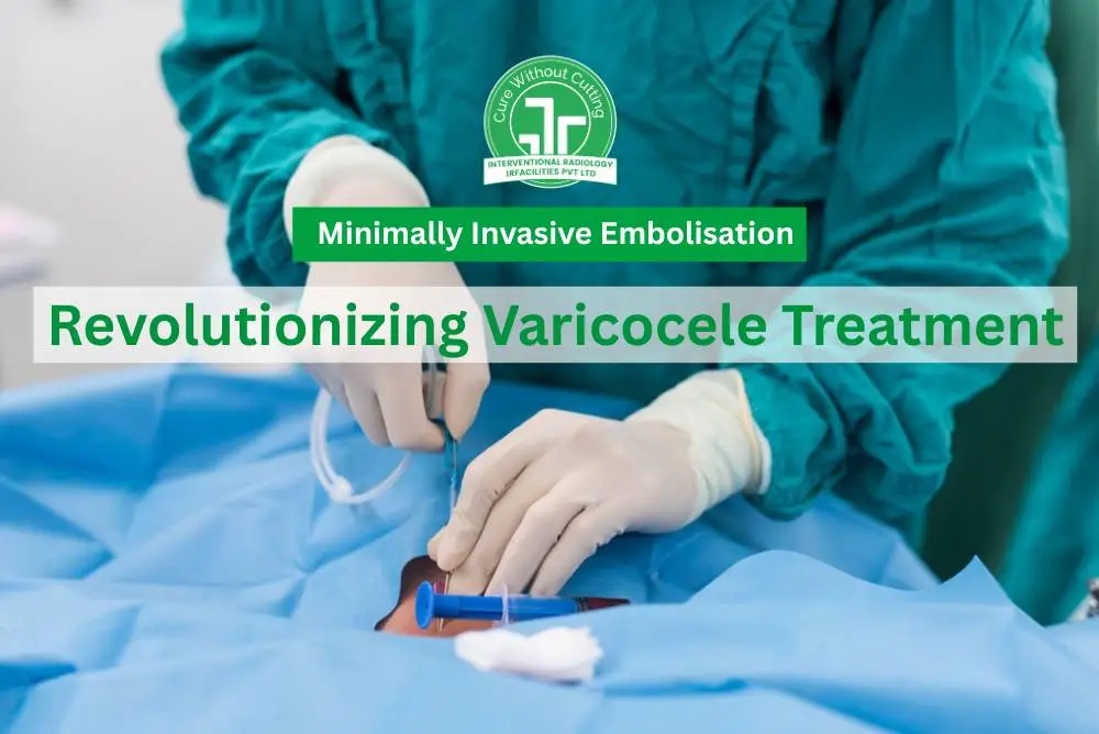 Varicocele Treatment