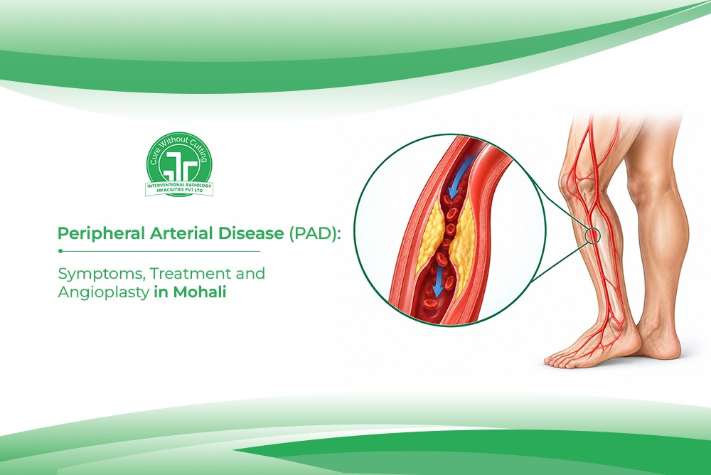 Peripheral Arterial Disease PAD Symptoms Treatment and Angioplasty in Mohali