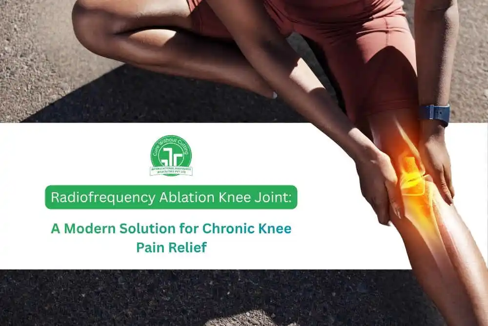 Radiofrequency Ablation Knee Joint A Modern Solution for Chronic Knee Pain Relief