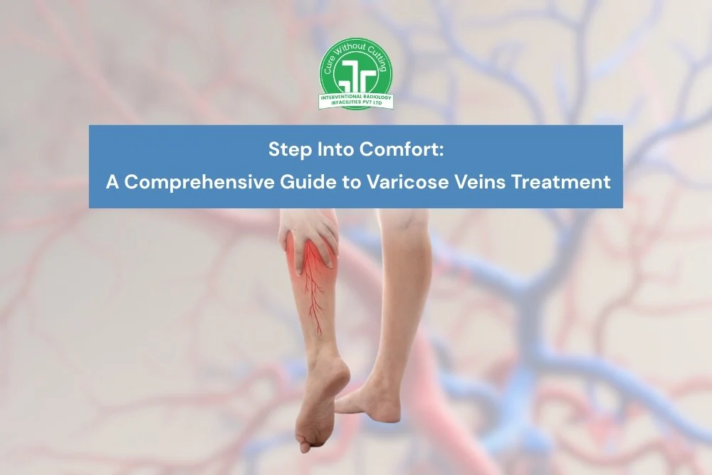Varicose Veins