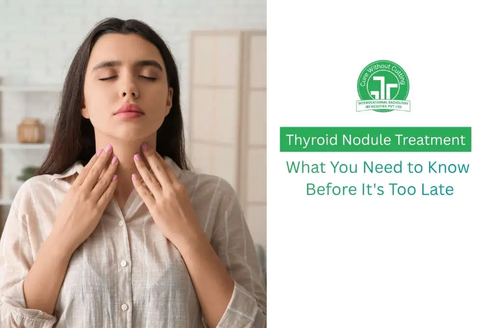 Thyroid Nodule Treatment: What You Need to Know Before It's Too Late