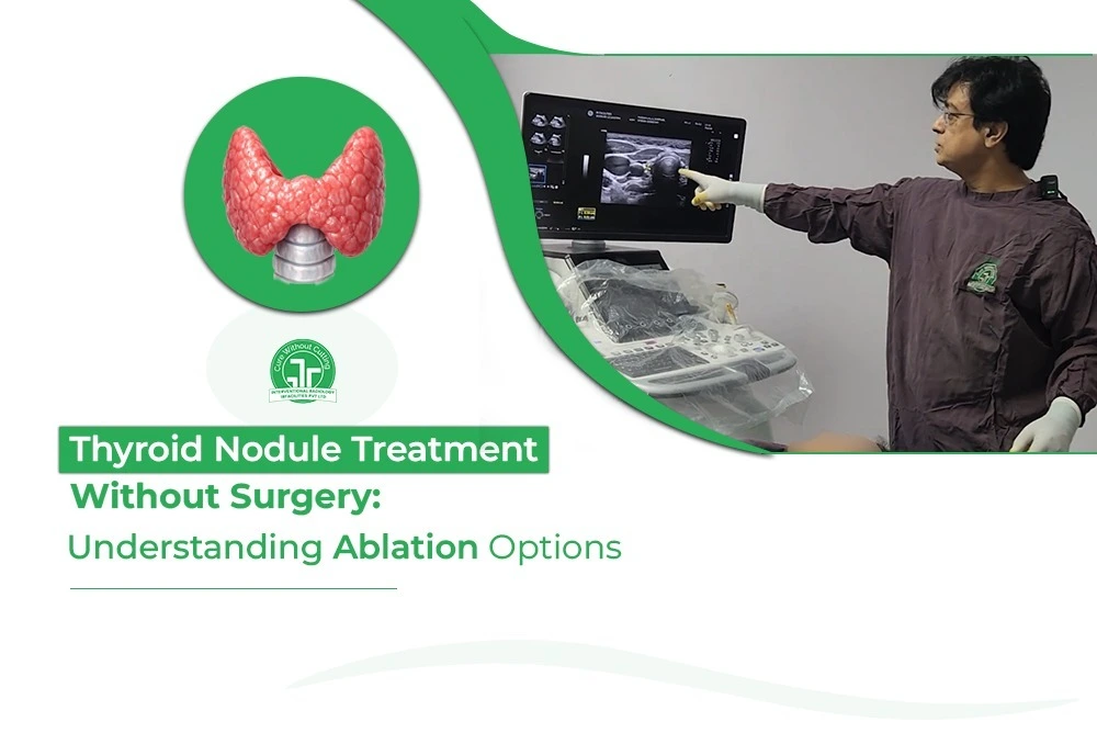 Carotid Artery Stenting A Minimally Invasive Treatment for Carotid Artery Blockage
