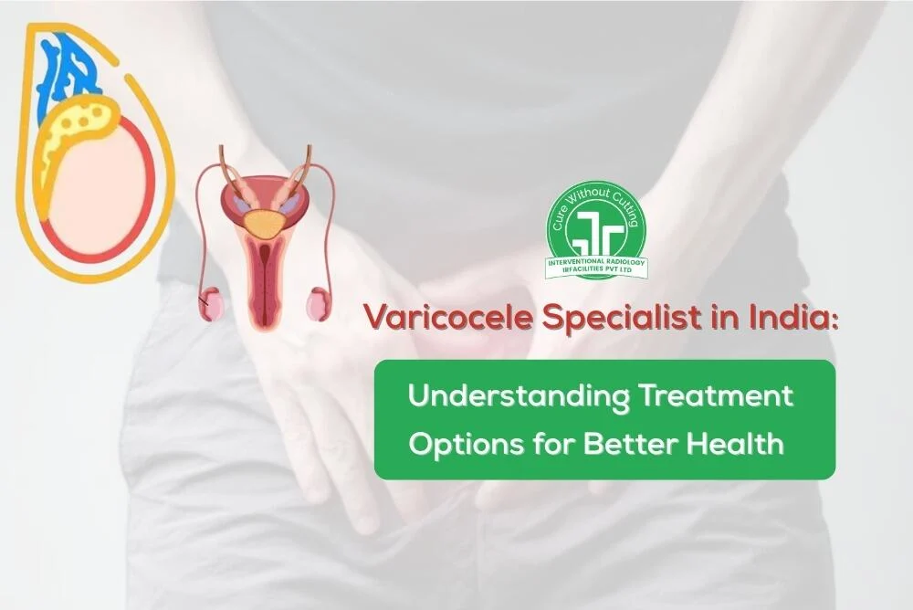Varicocele